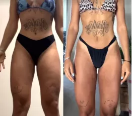 Antes e depois de aluna da equipe Will Portela
